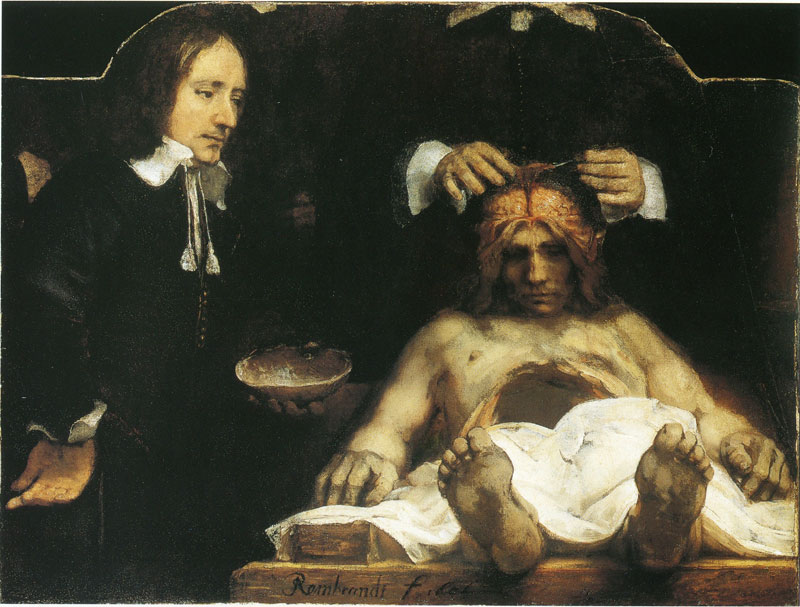 Rembrandt, Anatomy Lesson of Dr Joan Deyman, Amsterdam Museum